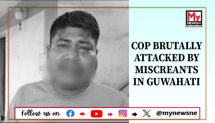 Cop brutally attacked by miscreants in Guwahati